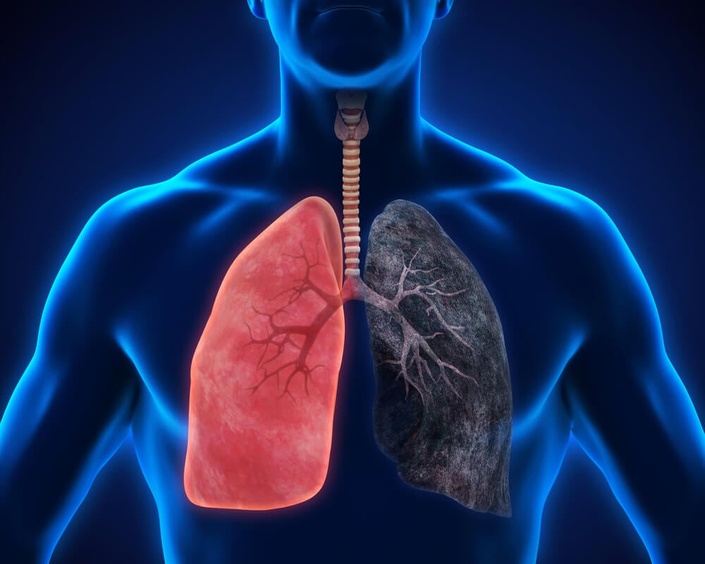 Los pulmones de un fumador - Image 2 - Nicorette - es-ES