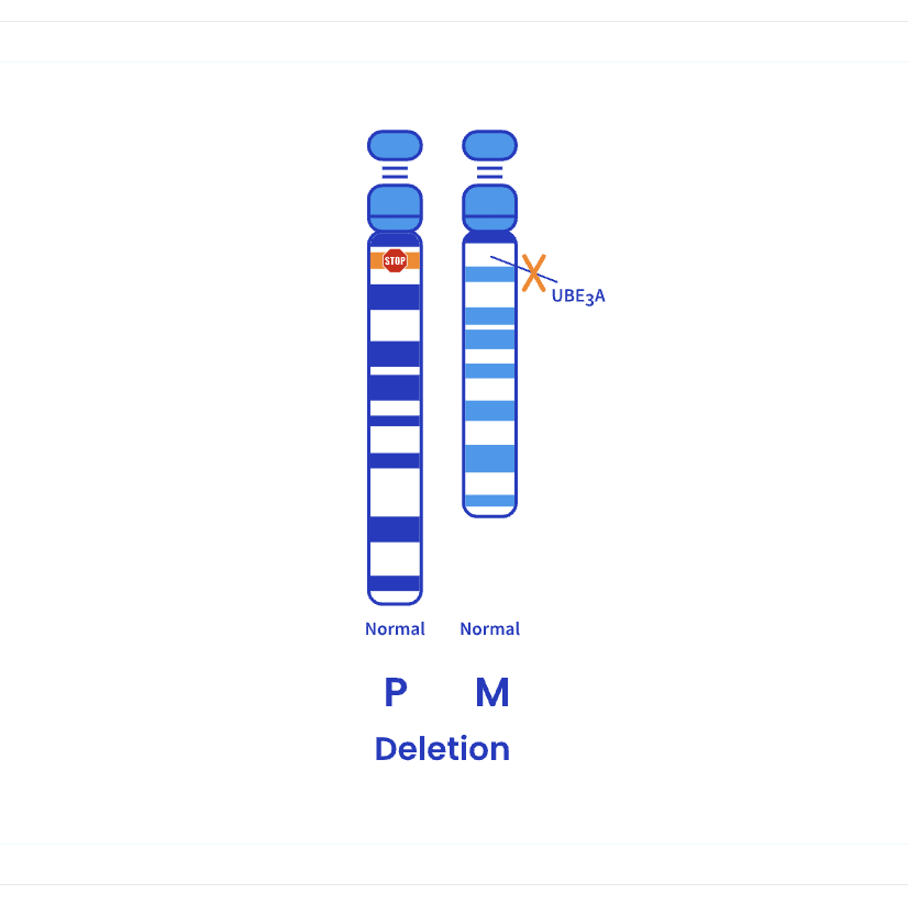 A deletion removes the normal expression of this gene in AS individuals
