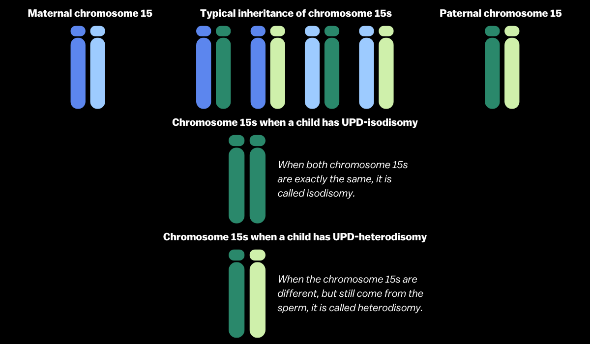 Understanding UPD Angelman syndrome and the difference between chromosome 15s for Typical Inheritance, UPD-isodismy, and UPD-heterodisomy.