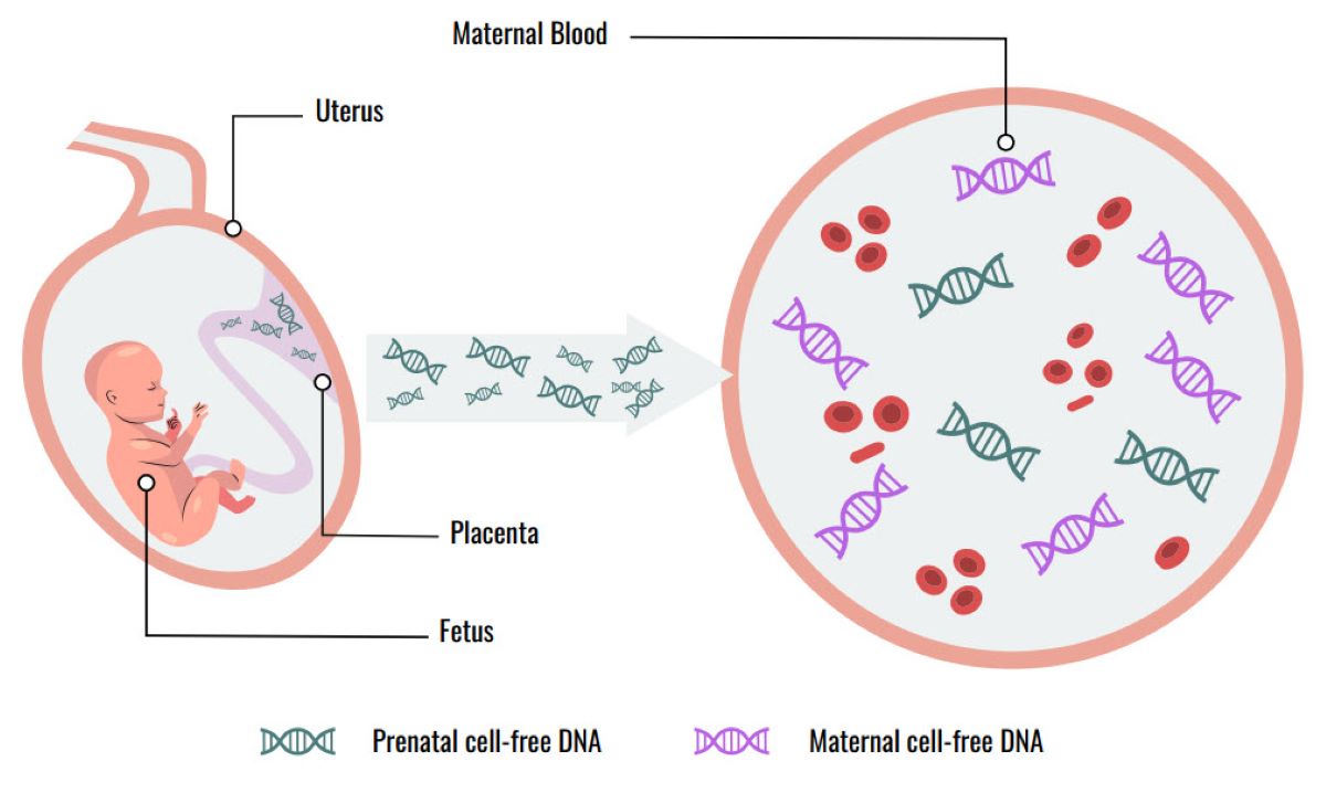 An illustration describing non-invasive prenatal screening (NIPS)