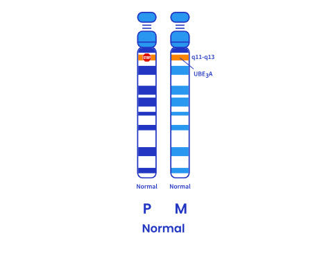 Graphic: normal chromosome 15 illustration