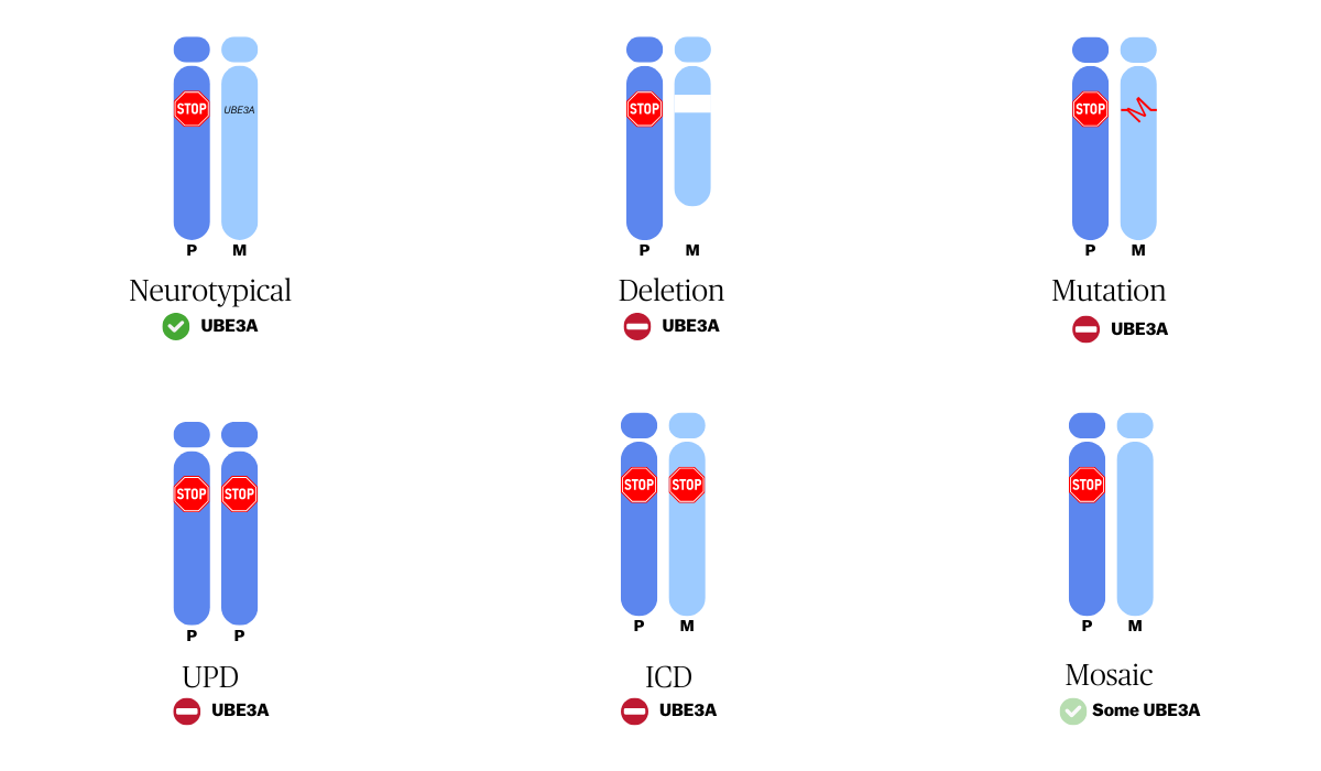 Showing neurotypical and 5 AS genotypes based on chromosome 15 impacts.