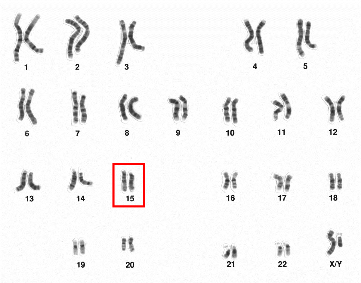 Human male Karyotype after G-banding. Chromosome 15 highlighted