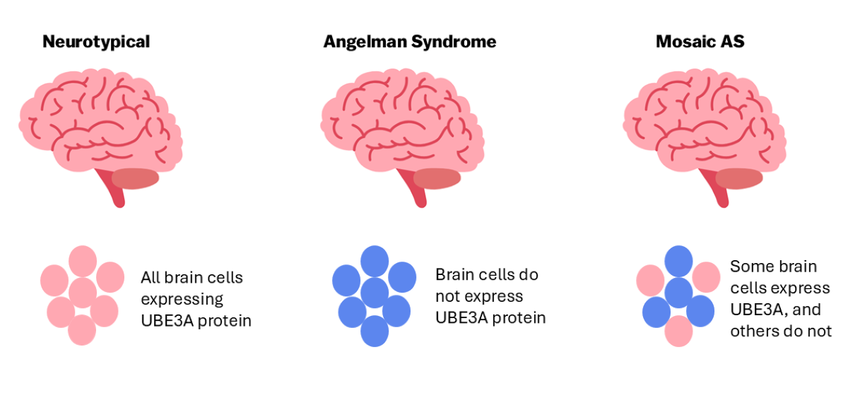 Mosaic AS UBE3A Protein 