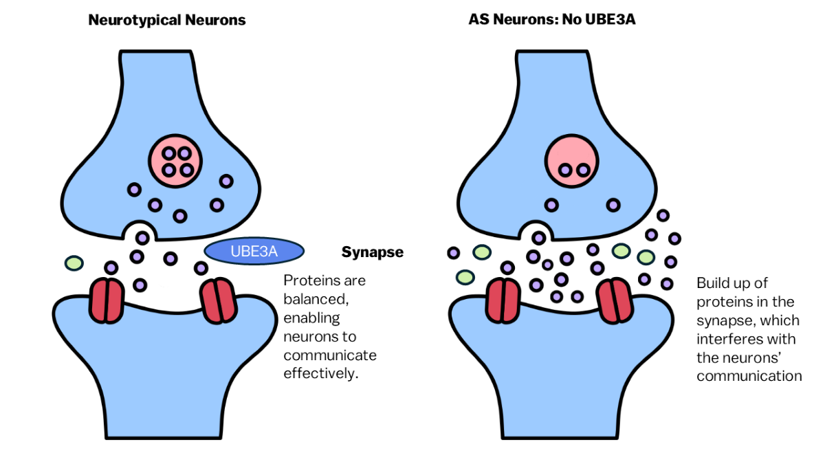 Image of neurotypical neurons vs AS neurons without UBE3A