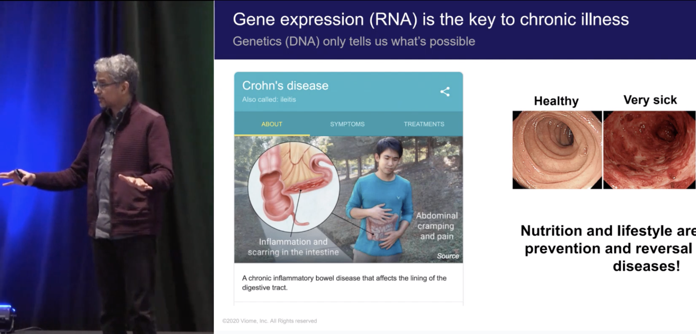 Machine Learning from Microbiome Metatranscriptomics Predicts Chronic Diseases - Guru Banavar, Viome