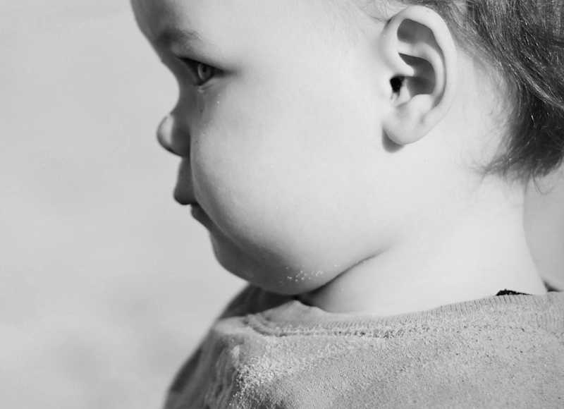 digeorge syndrome the future of stem cell therapy for the genetic