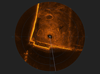 Cerulean Omniscan FS450 software test at Dora