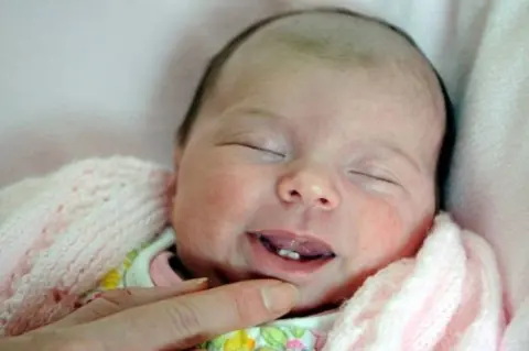 Mumsandbabes - Bayi Baru lahir Sudah Memiliki Gigi, Apa Penyebabnya ya Moms?