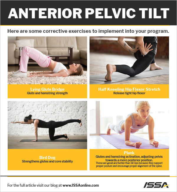 Anterior pelvic tilt: Fixes, causes, and symptoms