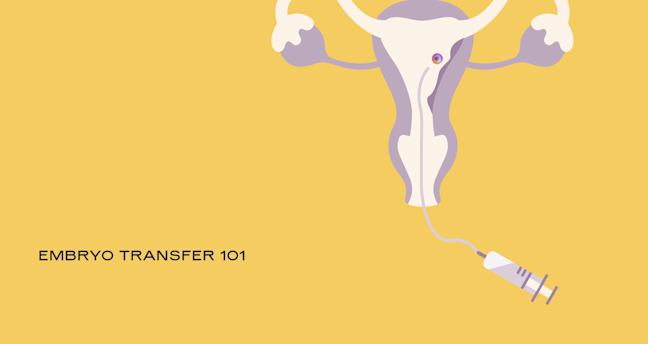 Operative Note Embryo Transfer Embryo Transfer 101: Your Guide to Embryo Transfer During IVF
