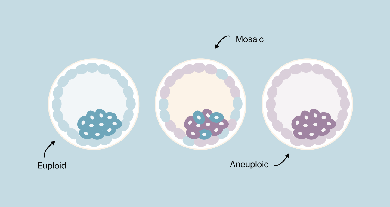 What Is a Euploid Embryo?
