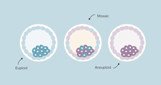 Euploid Example What Is a Euploid Embryo?