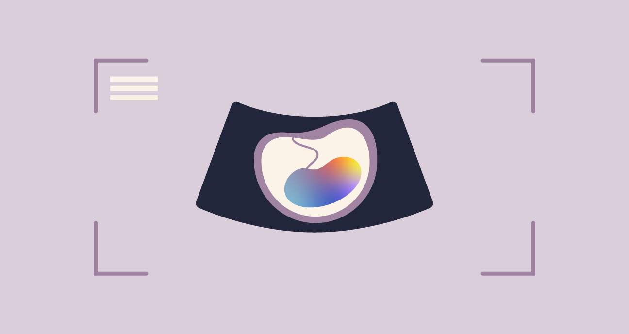 IVF Pregnancy What to Expect