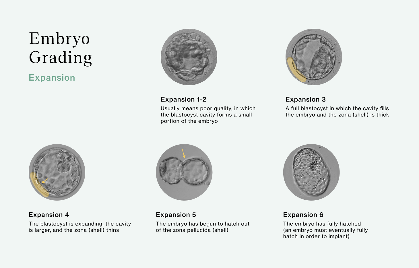 Embryo Grading Explained