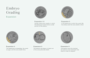 Embryo Grading Explained