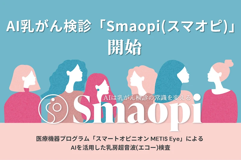 Revolutionizing Breast Cancer Screening with AI! AI Breast Cancer Screening "Smaopi" Launched
