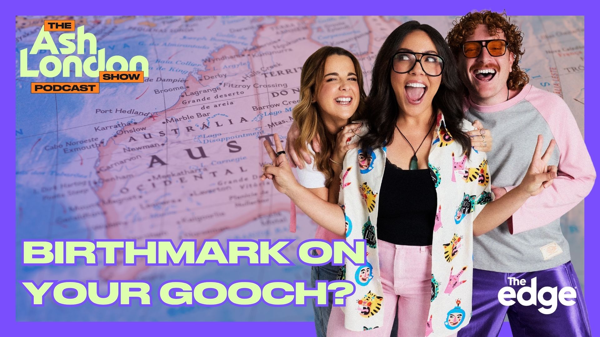 Birthmark on your gooch?