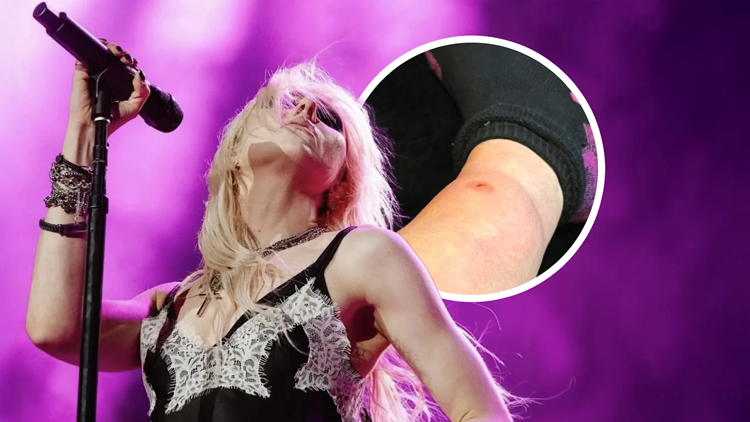 Taylor Momsen on stage + a photo of the spider bite on her leg