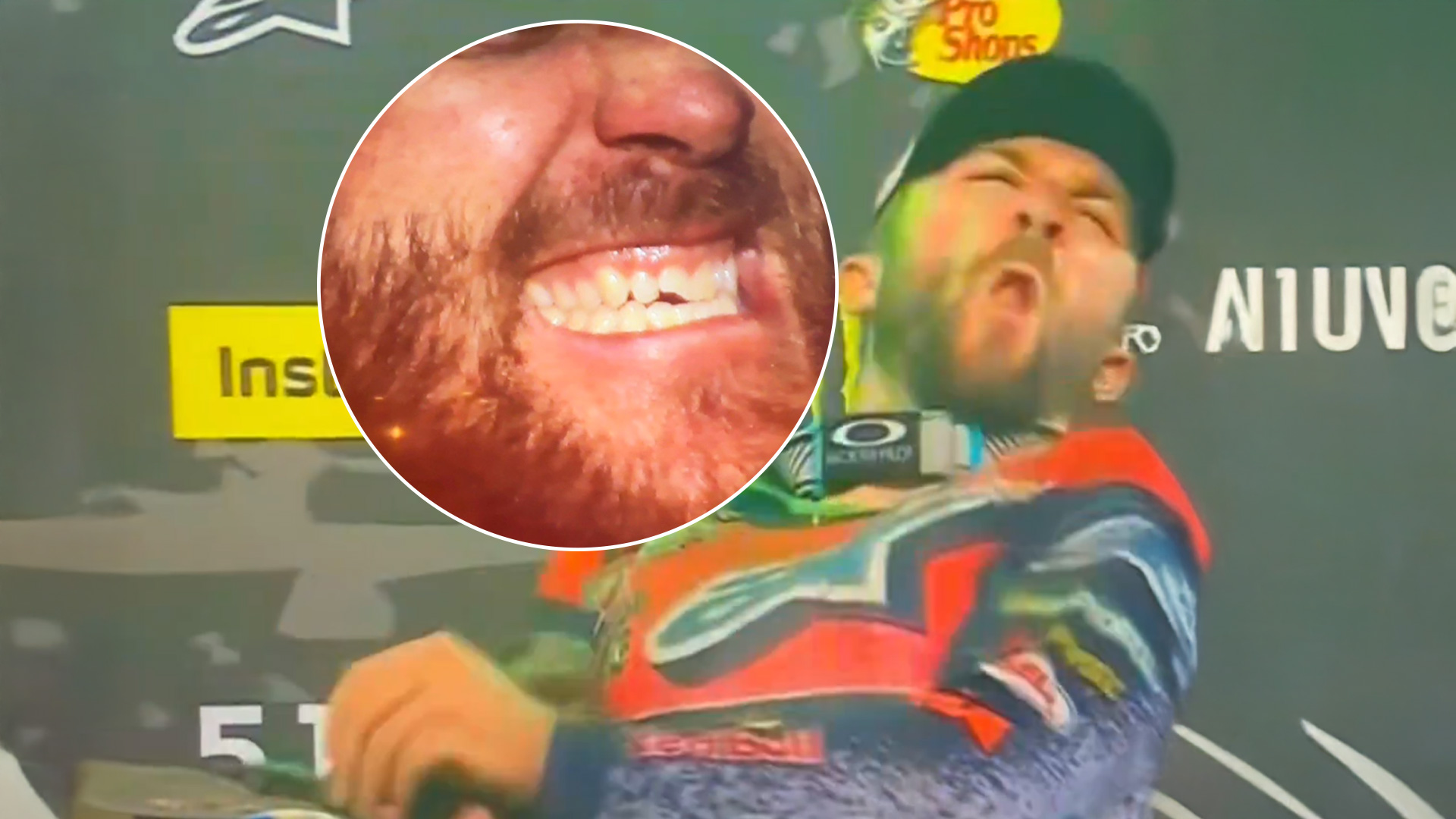 Watch: Daytona Supercross champ Eli Tomac loses a tooth to his own trophy 