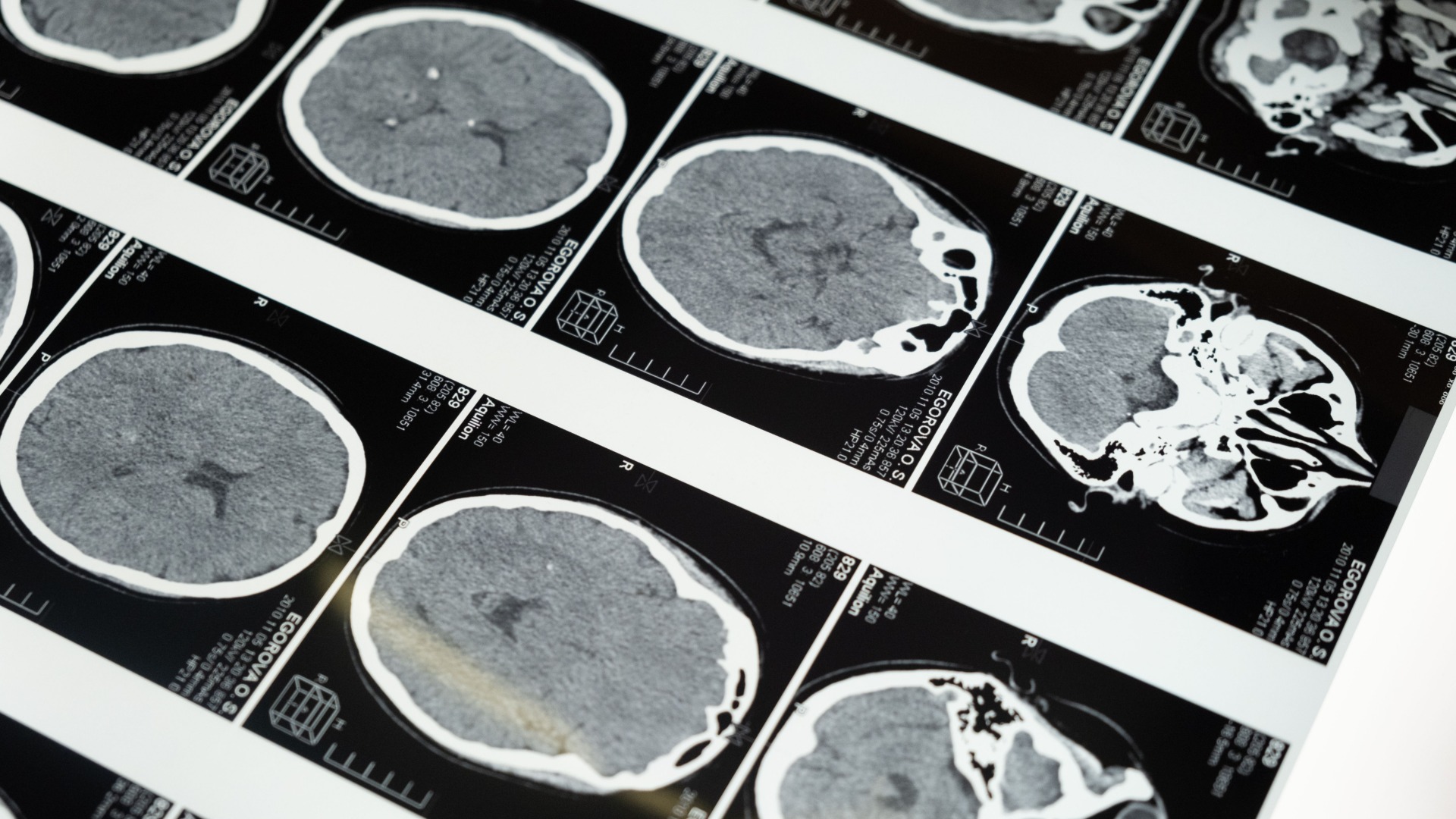 Volunteers being sought for world-leading ‘Brain WOF’