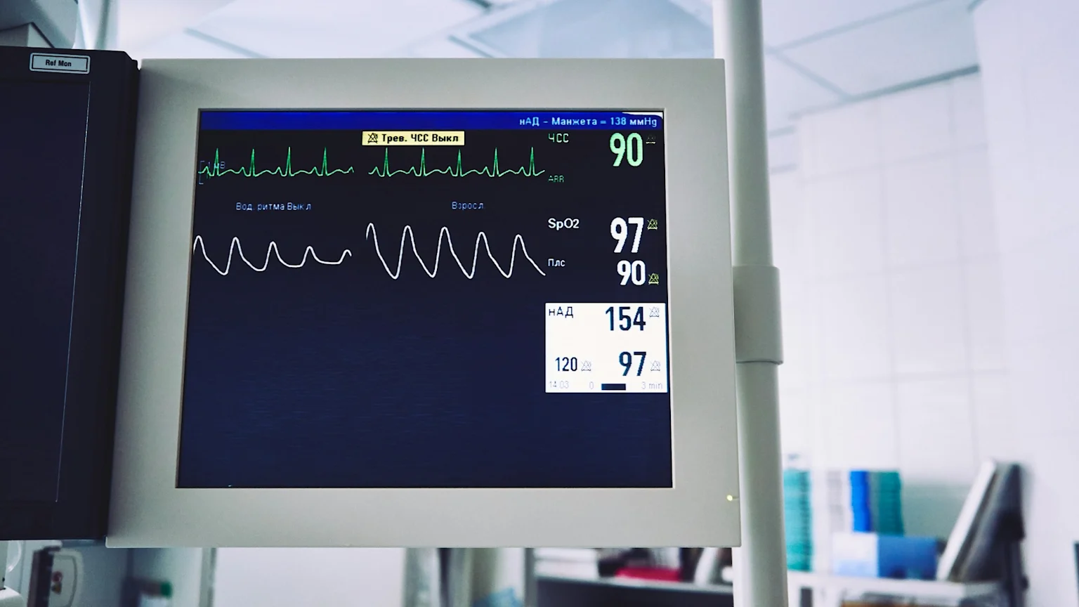 A medical monitor displays patient vital signs, including ECG waveforms, heart rate (90), SpO2 (97), and blood pressure readings, in a bright clinical environment.