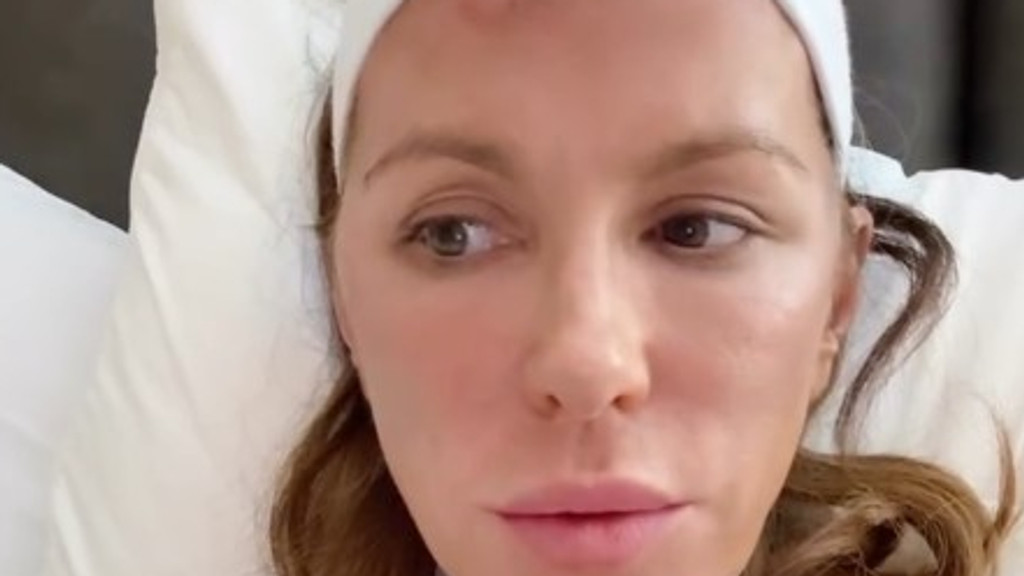 A close-up of Kate Beckinsale lying on a white pillow, wearing a white headband, with brown hair, a small red bump on her forehead, and a pensive expression looking to her left.