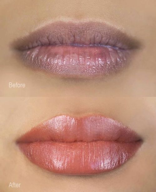 Lip Blushing Dark Lips