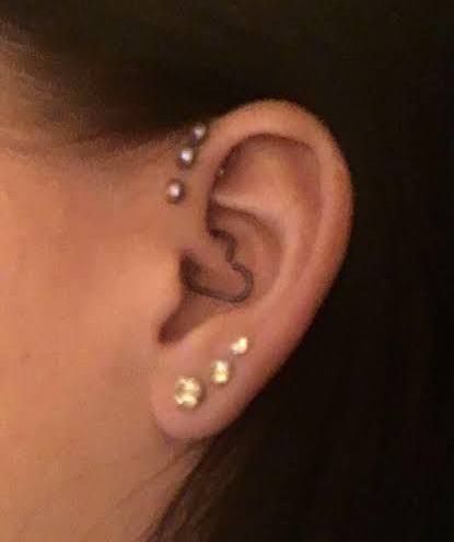 Triple Forward Helix & Lobes