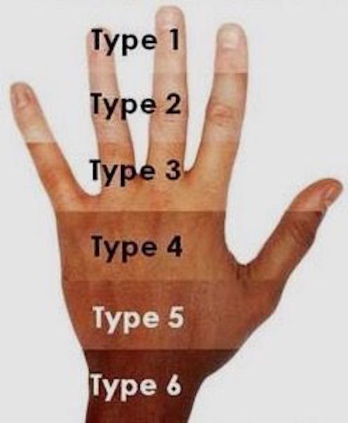 Fitzpatrick Scale Skin Chart