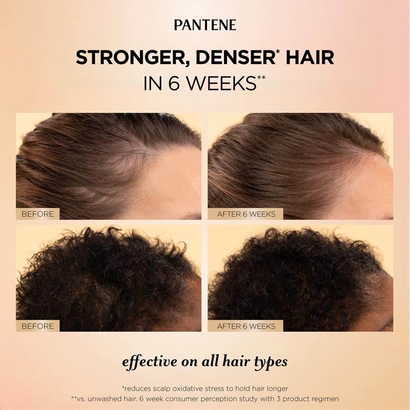A fair-skinned woman with straight brown hair and a dark-skinned woman with curly black hair shows before & after using Pantene abundant & strong daily scalp & root serum, the best treatment for hair loss for all hair types, against an amber background.