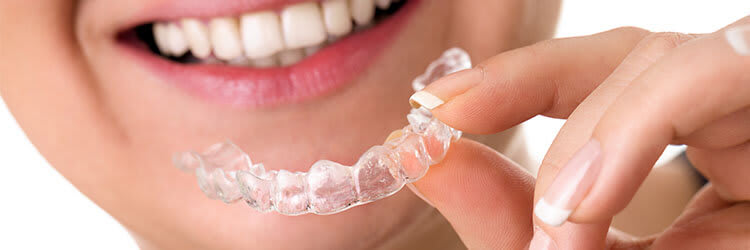 Mitä hammassuojat tekevät? article banner