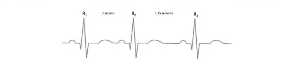 HRV for Dummies