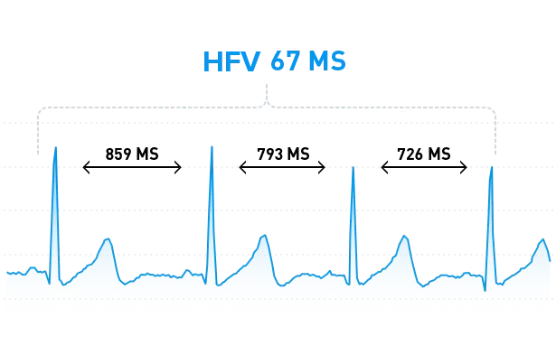 RR intervals show HRV