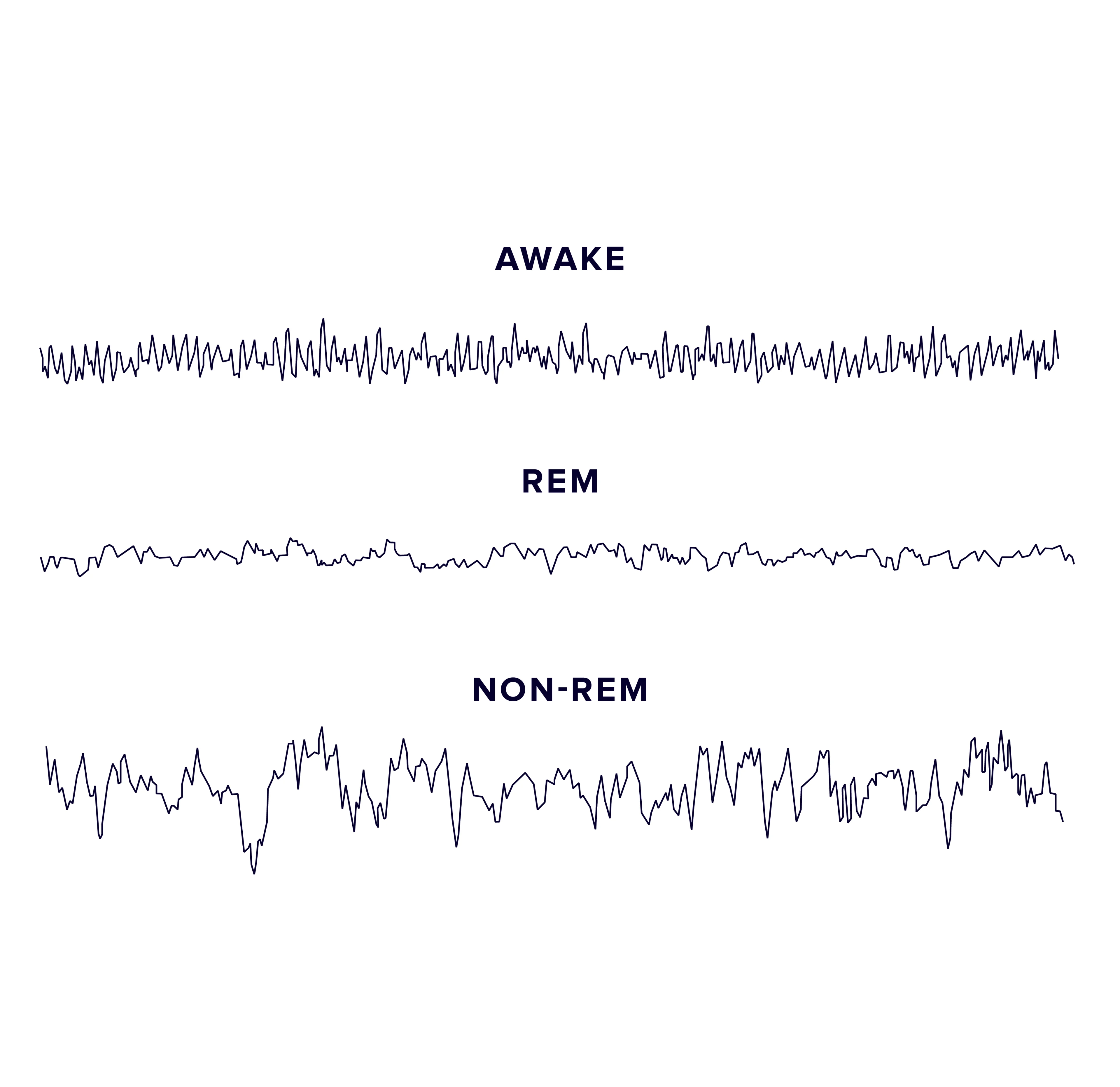 Brain waves in REM sleep