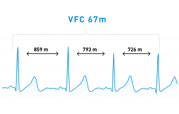 RR intervals show HRV