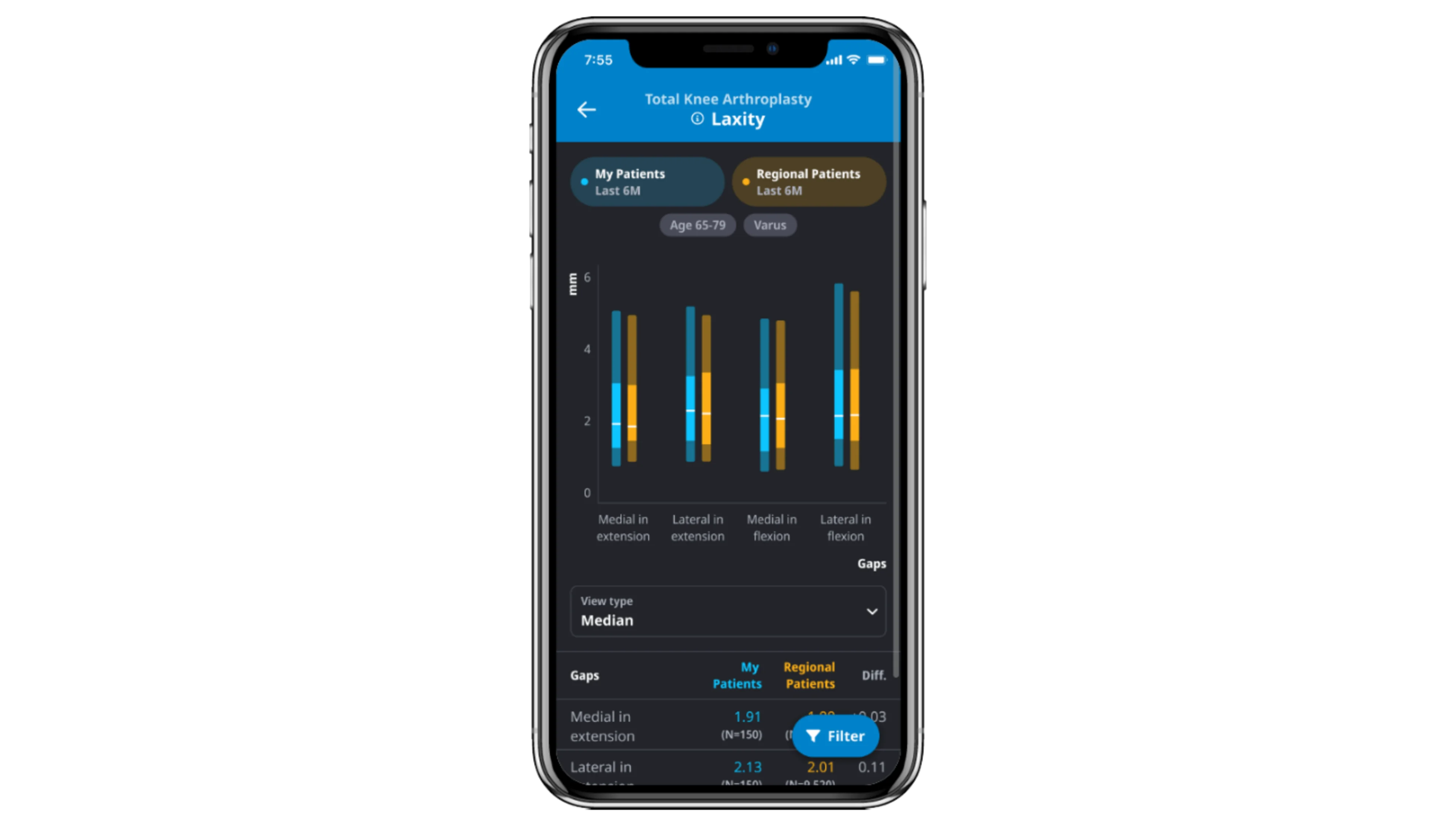 ZBEdge Analytics Key point | Image