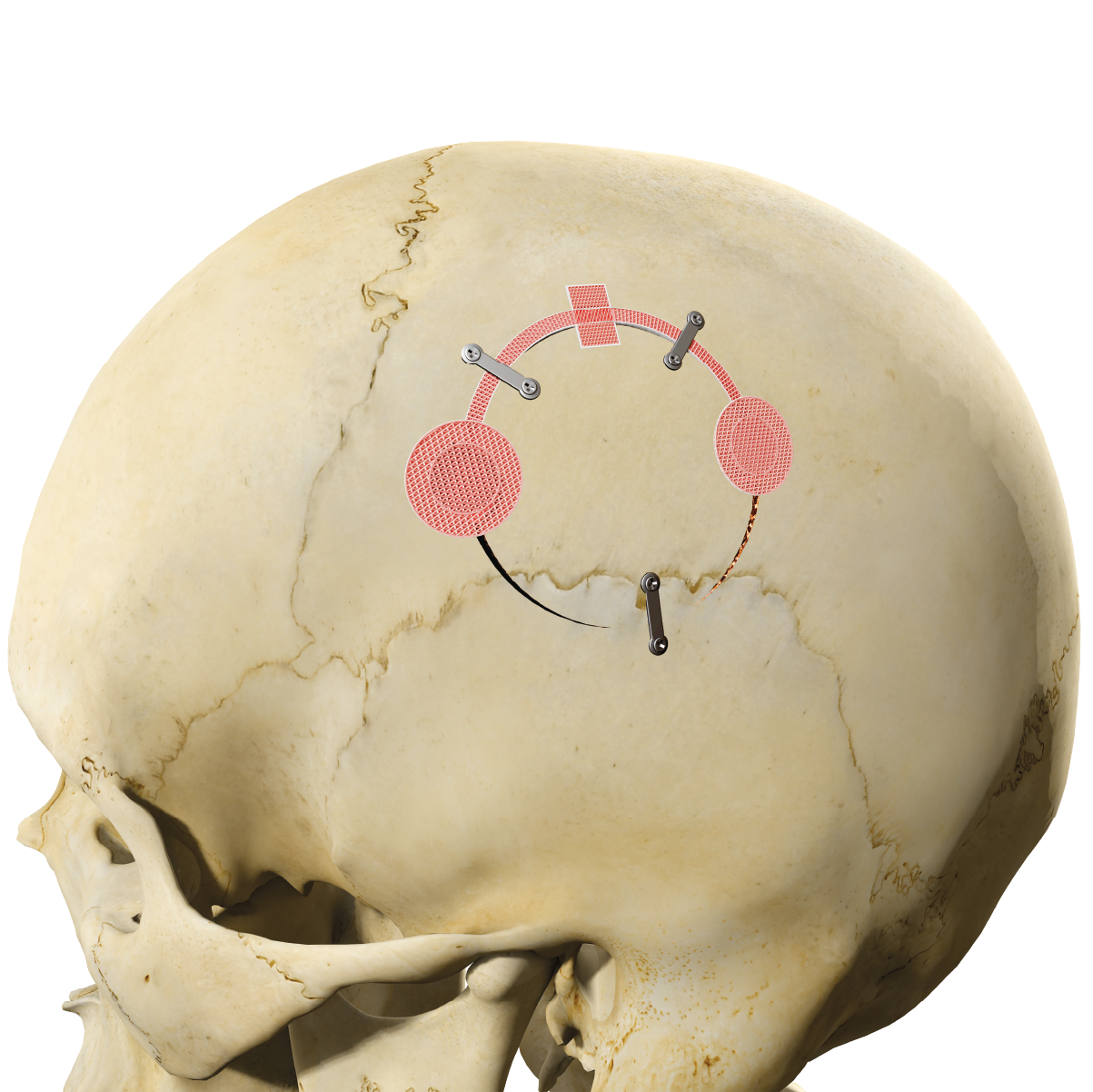 Osteopore Product Page | Main Image