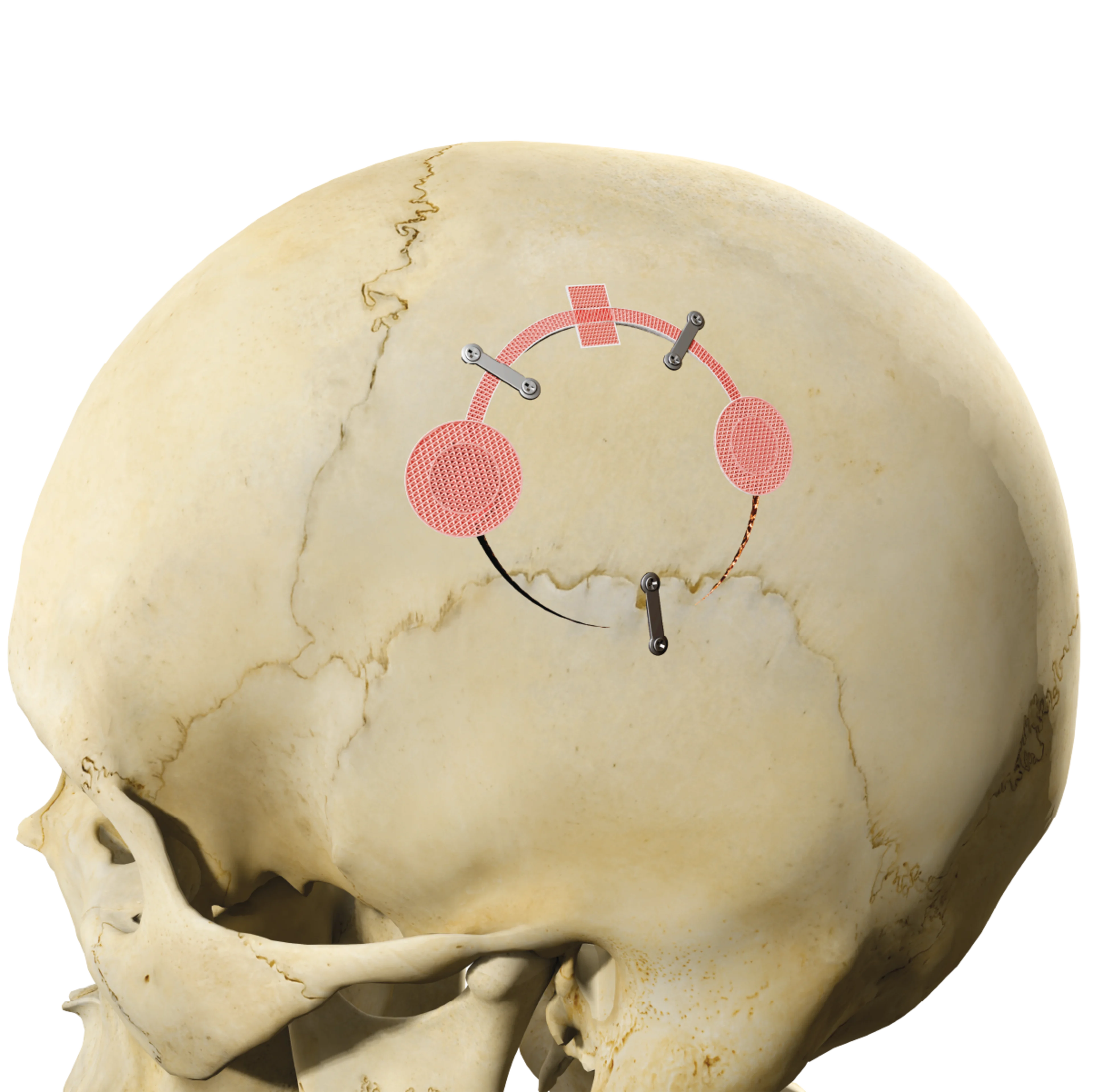 Osteopore Product Page | Main Image