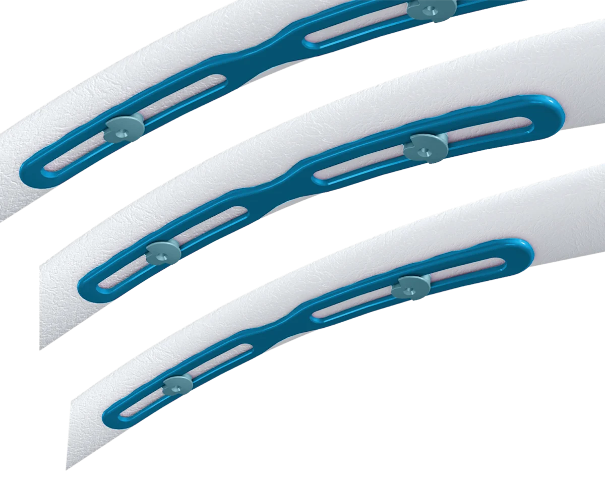 Zimmer Ribfix RibFix Advantage® | Zimmer Biomet | Zimmer Biomet