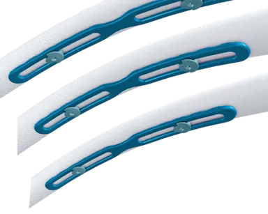 Zimmer Ribfix RibFix Advantage® | Zimmer Biomet | Zimmer Biomet