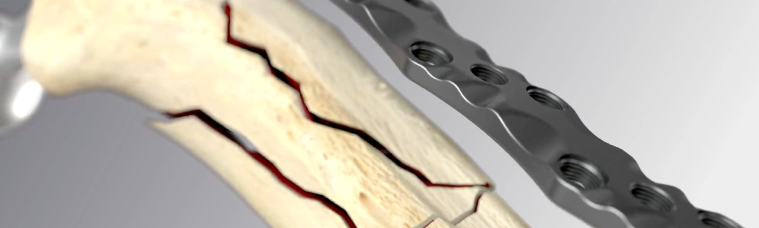 NCB PP Campaign | Header Image 