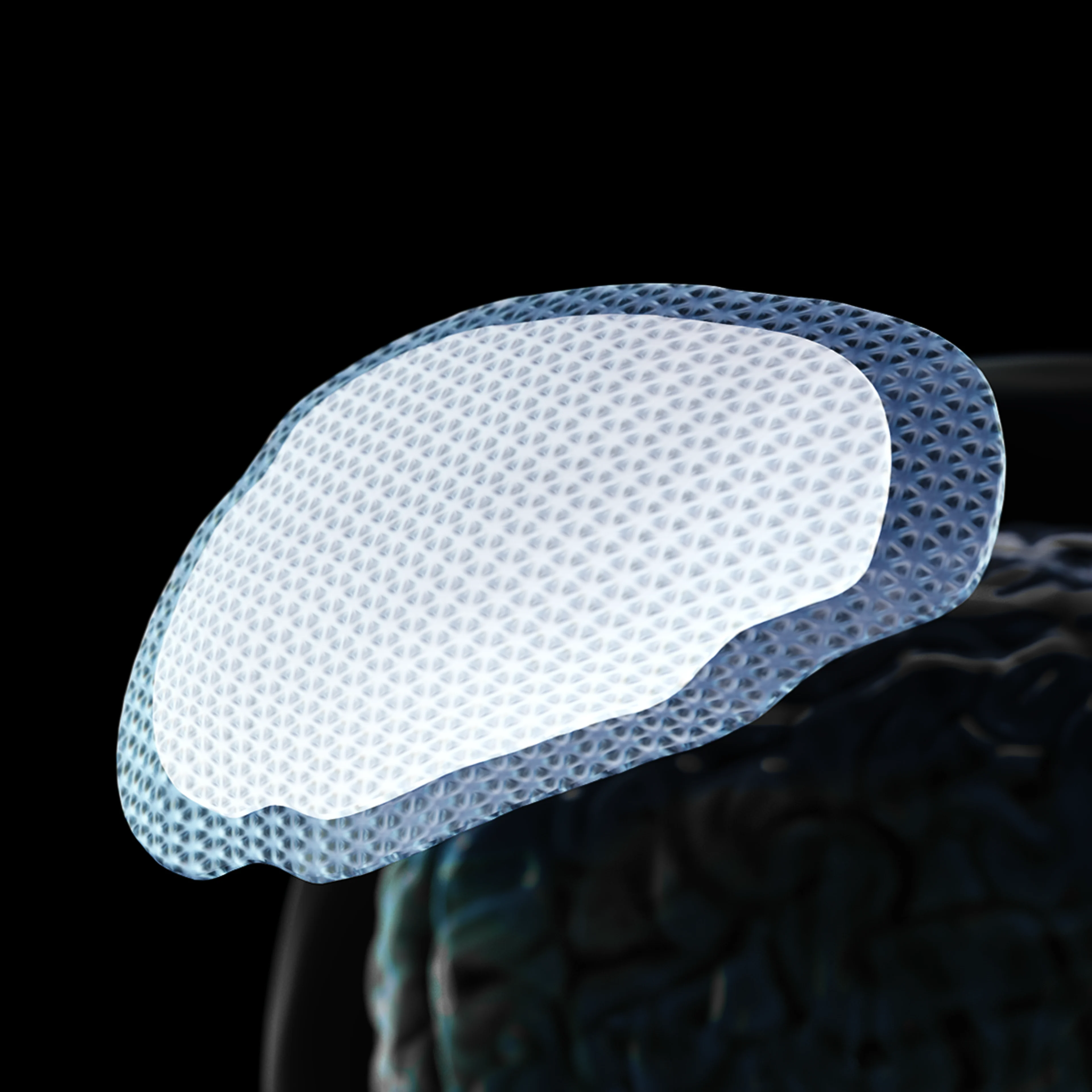 Osteopore Campaign | USP Image