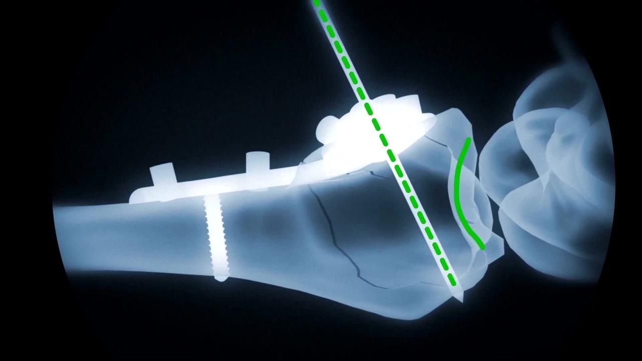 DVR Video | Poster Image