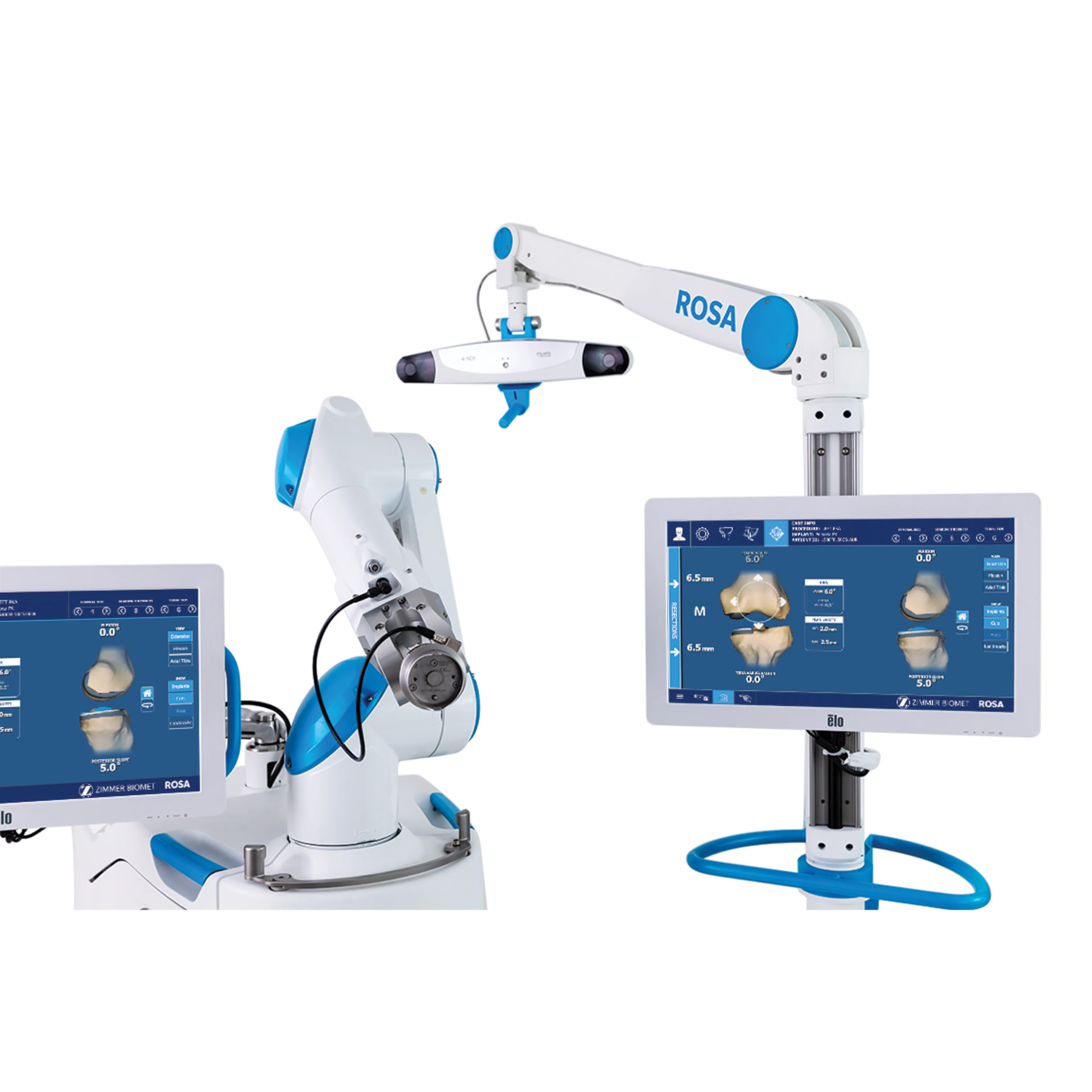 ROSA PKA | USP Image