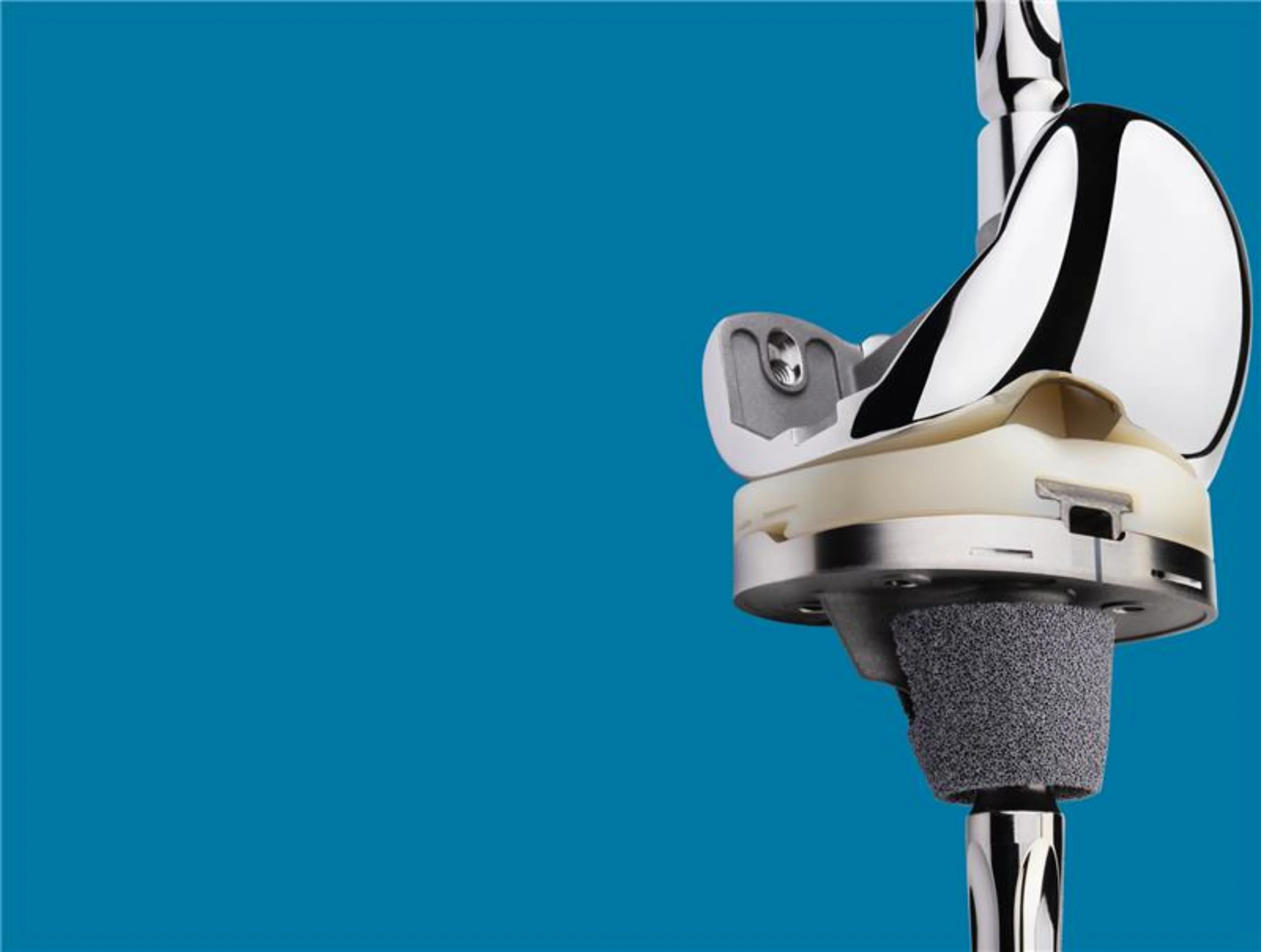 Persona Revision Knee Promo Image