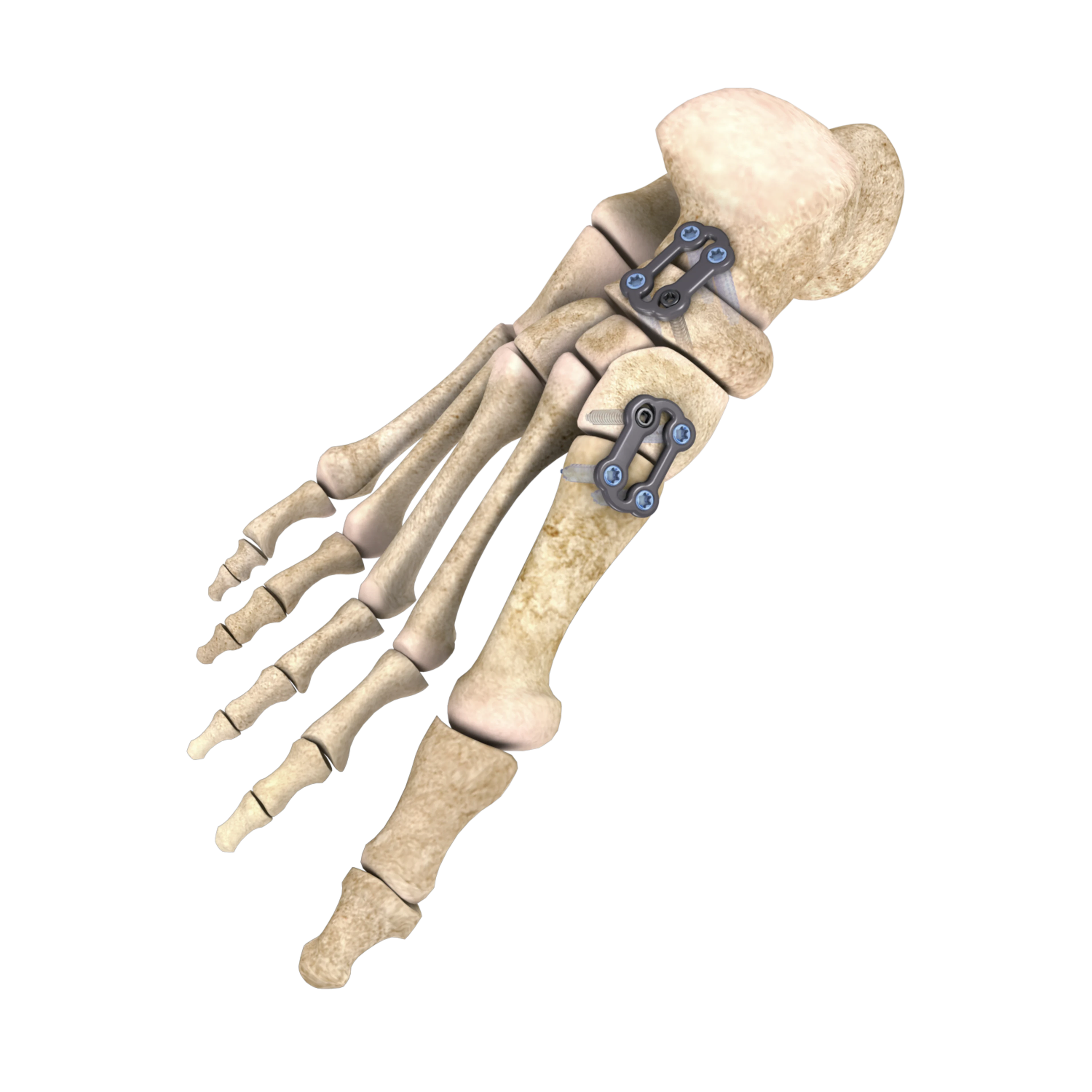 A.L.P.S. Total Foot | Main Product Image