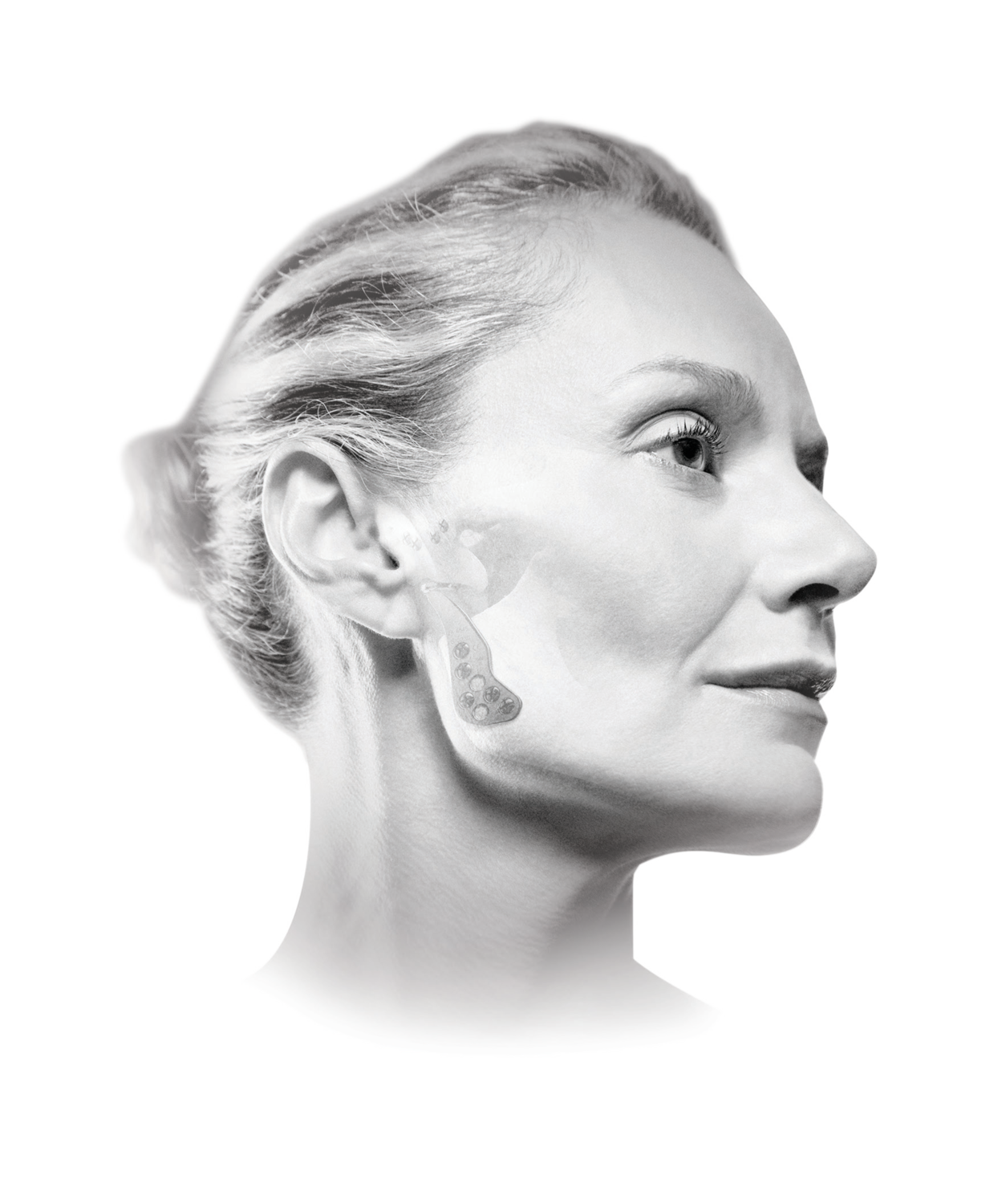 CMF Trauma and Reconstruction | Section Image 