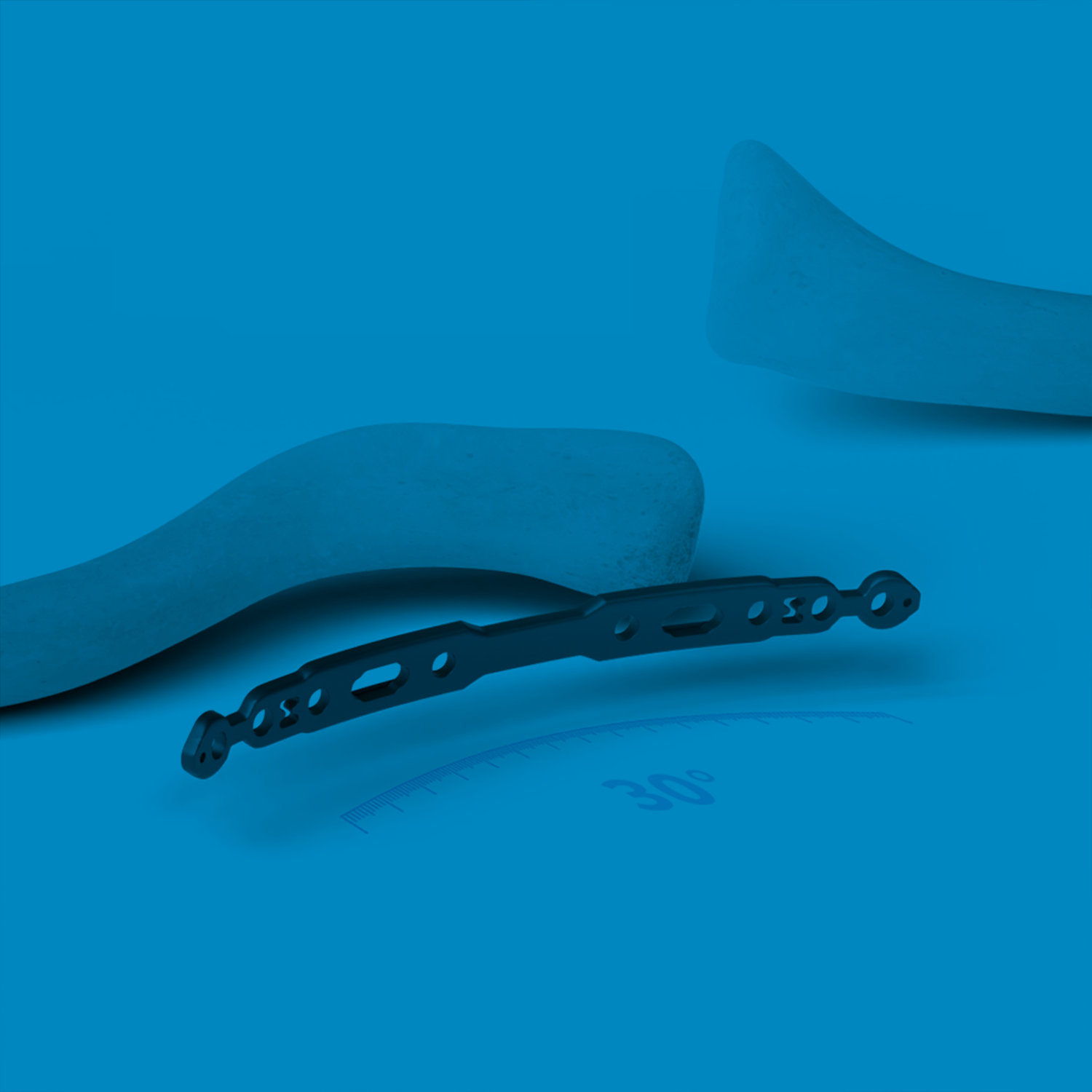 ALPS Clavicle | Promo Card Image