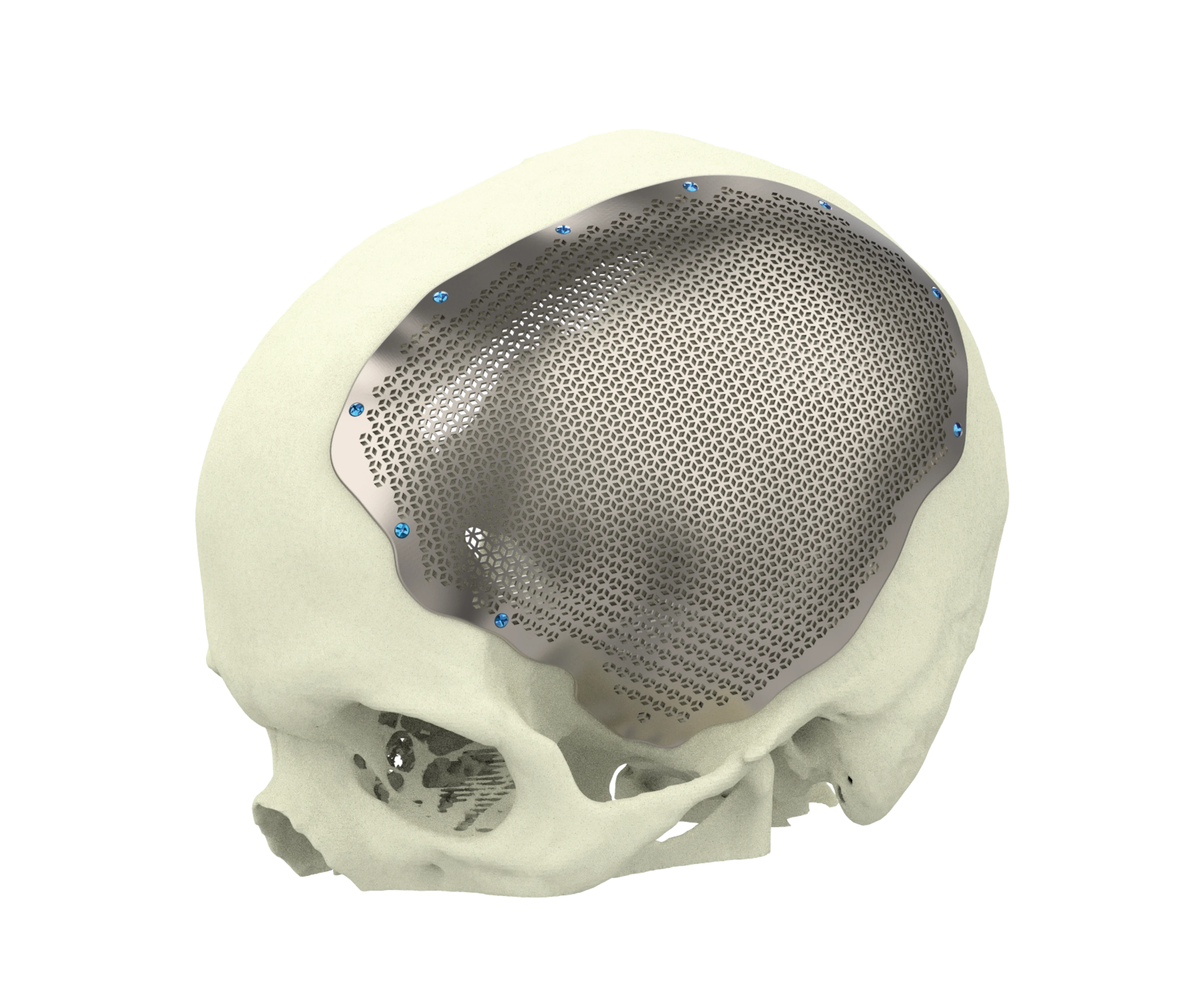 One2One Titanuim Cranial | Main Product Image